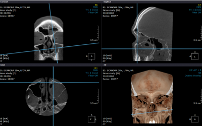 Despre radiografii dentare si tomografii – Tehnologie de ultima ora